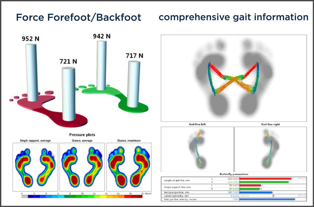 FOOTMOTION WEB 6 1024x675